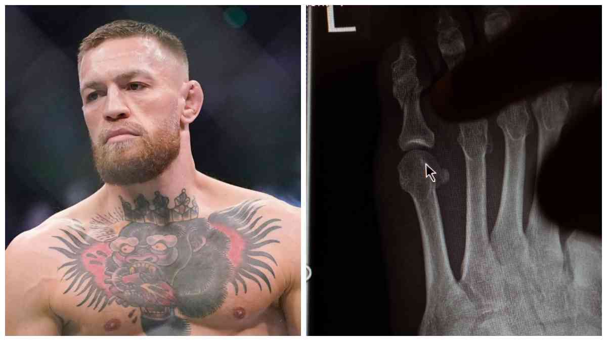 Una Fractura La Raz N Por La Que Conor Mcgregor No Pelear En Ufc