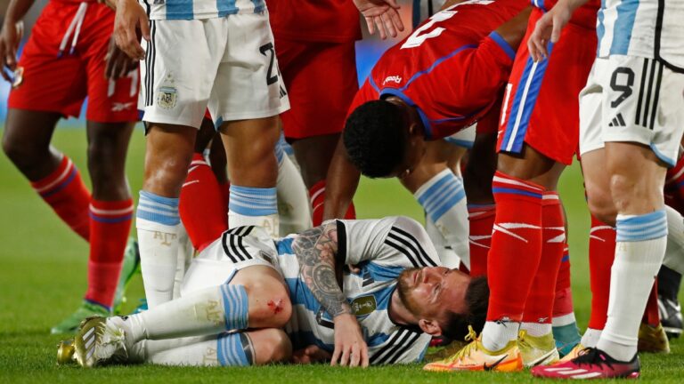 Leo Messi sufre una fuerte entrada ¡El argentino tenía sangre en la rodilla!