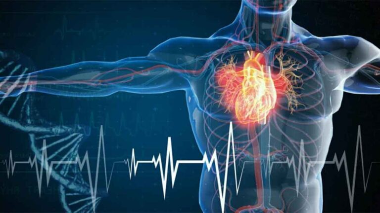 ¿Qué es un infarto agudo de miocardio? Causas y síntomas
