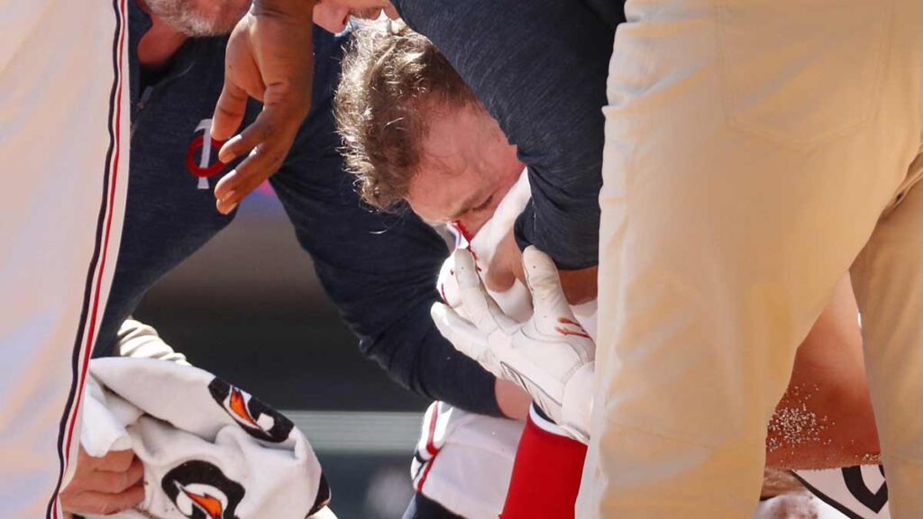 Kyle Farmer es atendido después de haber sido golpeado en la cabeza por un lanzamiento. Reuters