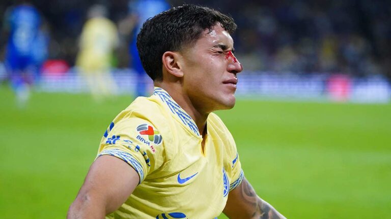 Alejandro Zendejas presume su fractura de nariz tras choque en el América vs Monterrey