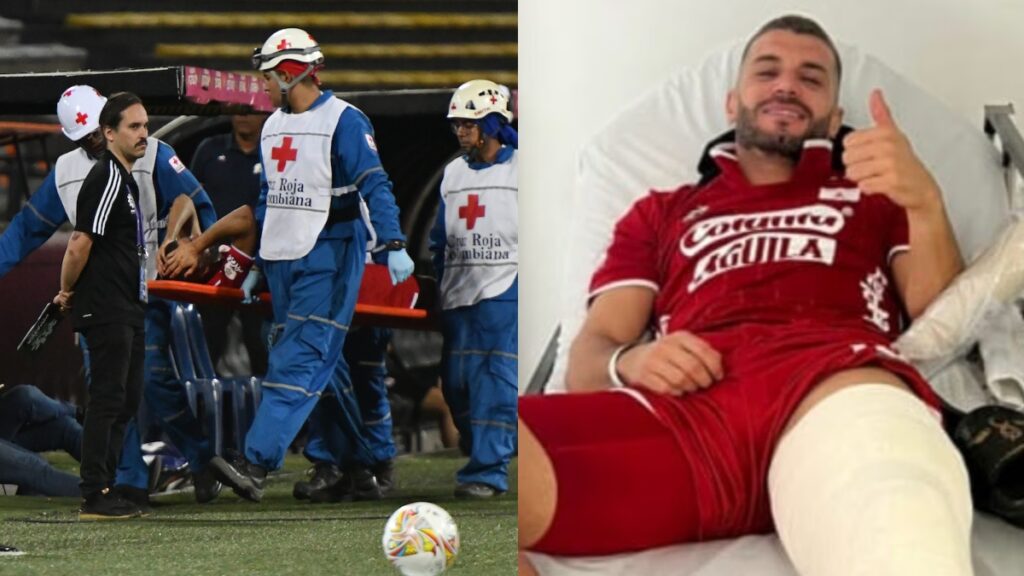 América confirma fractura de tibia de Iago Falque.