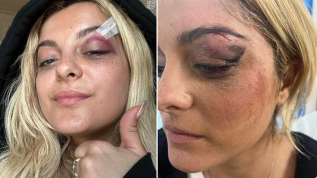 Bebe Rexha fue golpeada por un celular lanzado al escenario. @beberexha