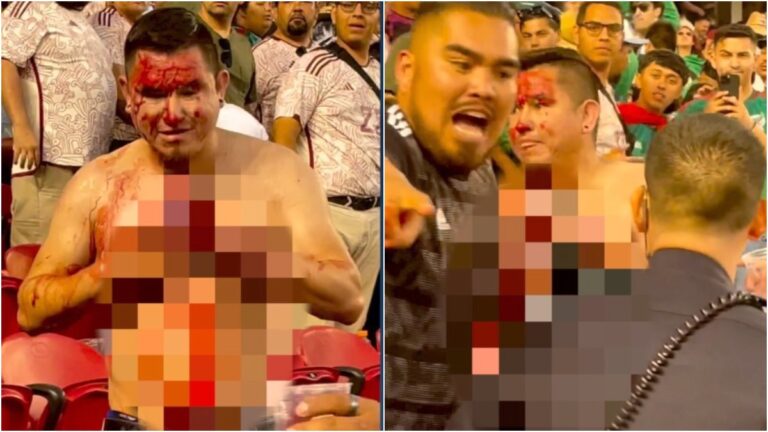 Vergonzosa imagen de la afición mexicana en la Copa Oro ¡Hubo un herido con arma blanca!