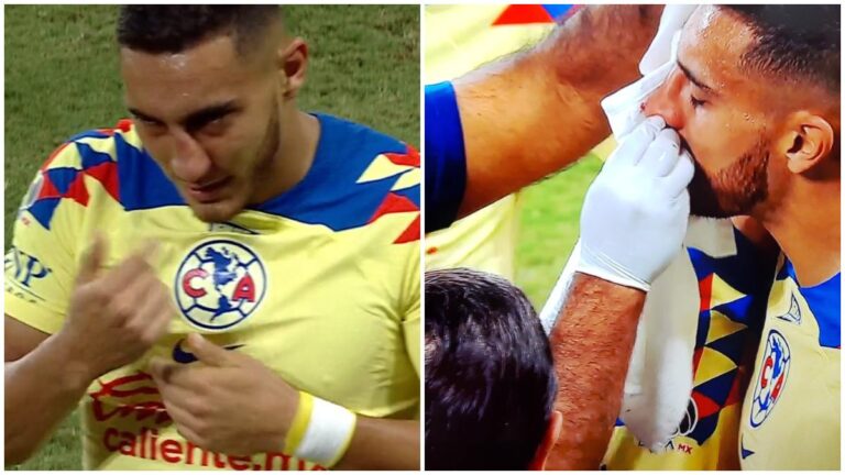 ¡Horrible! Sebastián Cáceres se fractura la nariz tras un choque con Fafà Picault