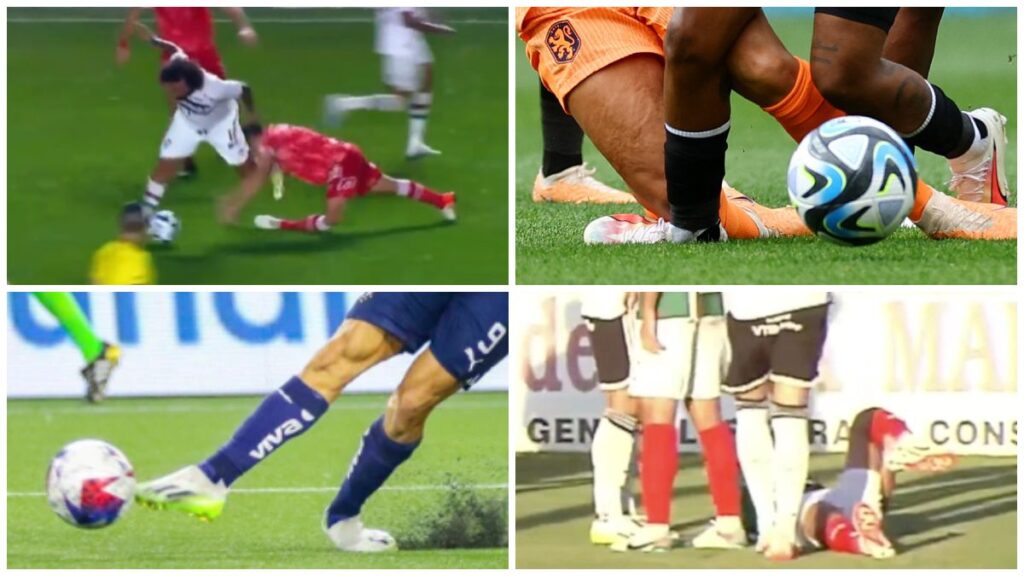 Esta semana, lamentablemente, se suscitaron diversas lesiones espeluznantes en diversas canchas de fútbol alrededor del mundo.