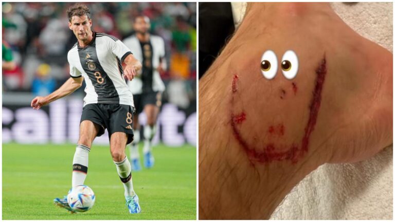 Leon Goretzka enseña fuerte herida tras el empate entre México y Alemania