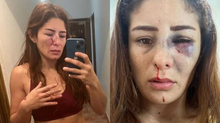La luchadora mexicana, Daniela López, denuncia agresiones físicas por parte de su expareja