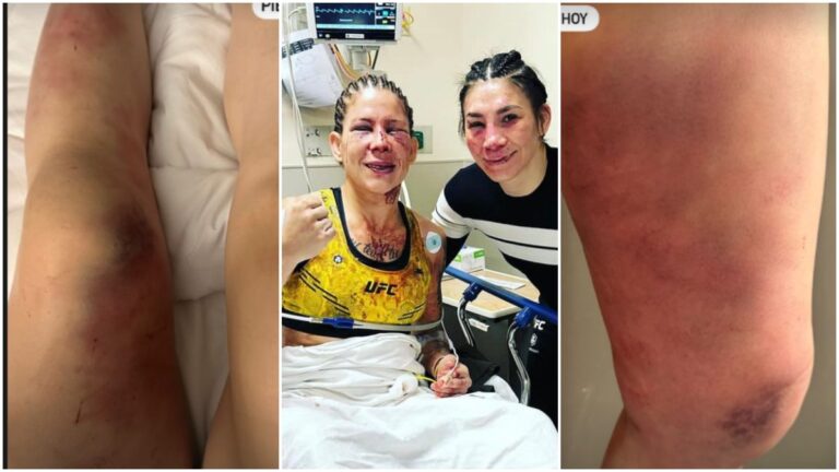 Irene Aldana muestra las heridas de la batalla tras la victoria ante Karol Rosa en UFC 296