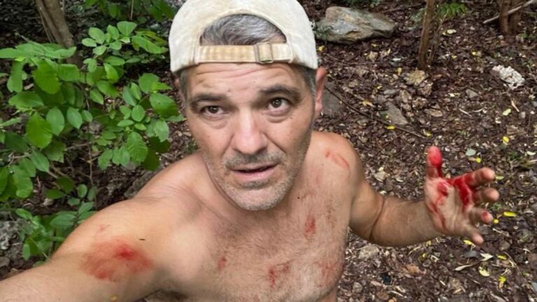 Frank Cuesta al borde de la muerte tras ser atacado por un ciervo