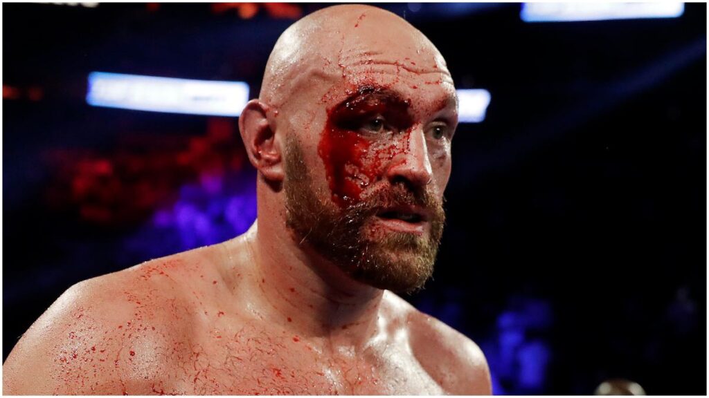 Tyson Fury, campeón del CMB, sufre un corte en el ojo | AP