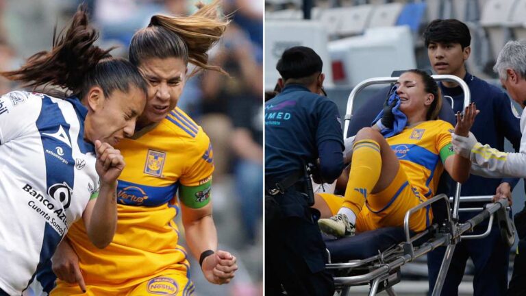 ¡Escalofriante! Nayeli Rangel sufre una fractura en el rostro por un fuerte choque con Dulce Eileen Martínez