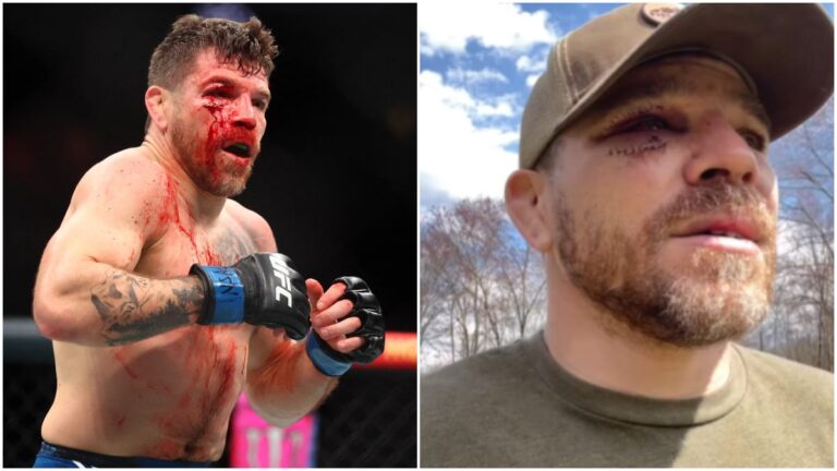 Jim Miller revela los estragos de UFC 300: mano rota, dedo del pie fracturado y 25 puntos en la cara