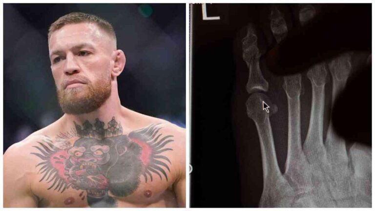 Una fractura, la razón por la que Conor McGregor no peleará en UFC 303