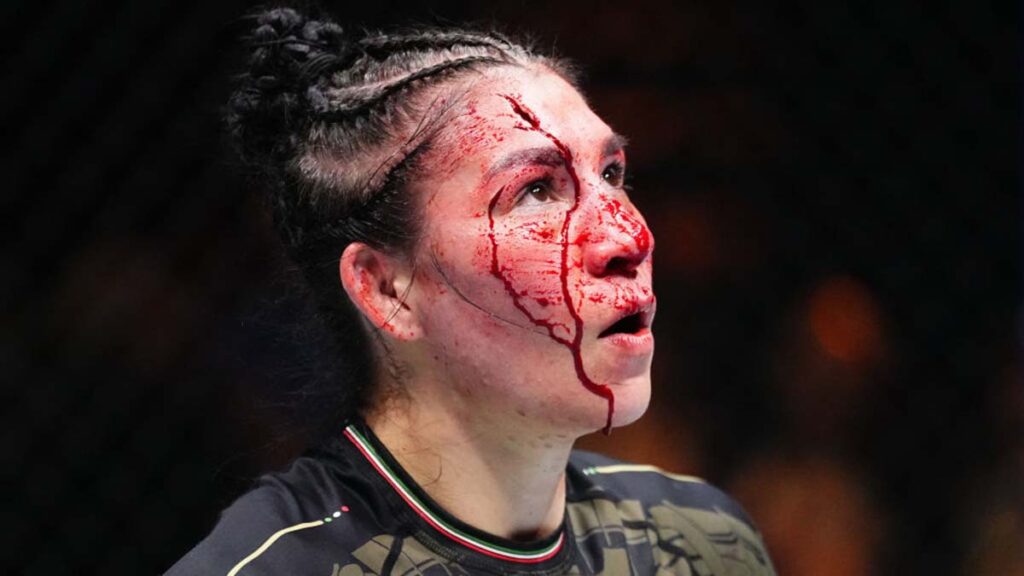 Irene Aldana se lleva brutal corte en la frente y cae ante Dumont | Jeff Bottari / Getty Images