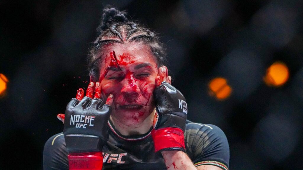 ¡De terror! Así quedó el rostro de Irene Aldana tras el cabezazo de Norma Dumont en la Noche UFC