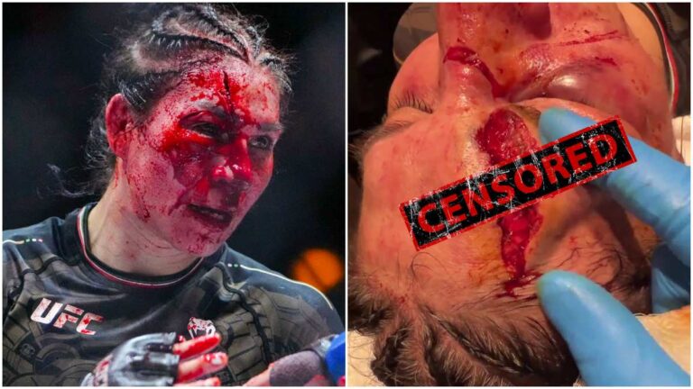 Las impresionantes imágenes de Irene Aldana tras llegar a urgencias por el corte que sufrió en la Noche UFC