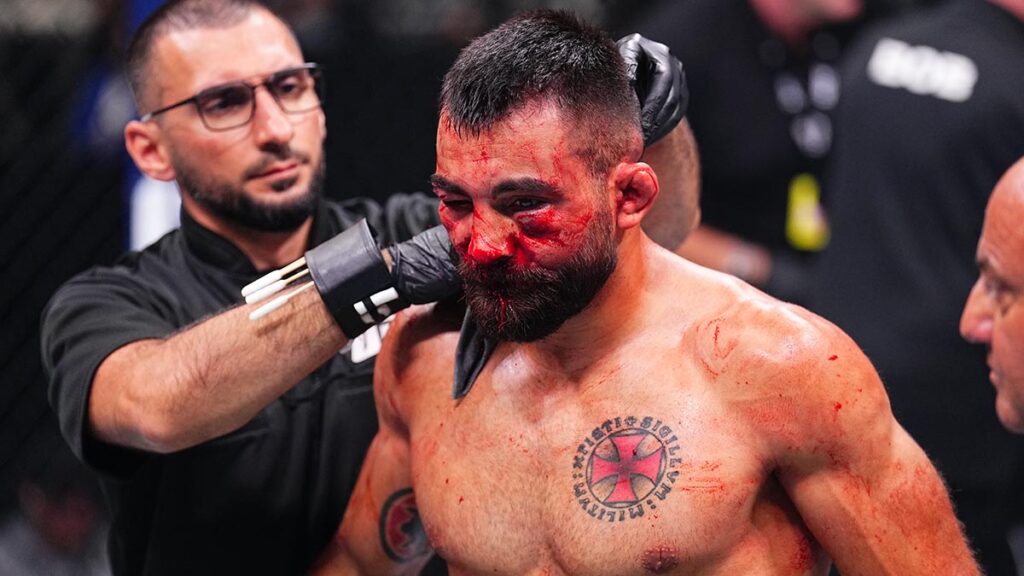 Renato Moicano destroza el rostro de Benoit Saint Danis en la pelea estelar del UFC Fight Night de Paris