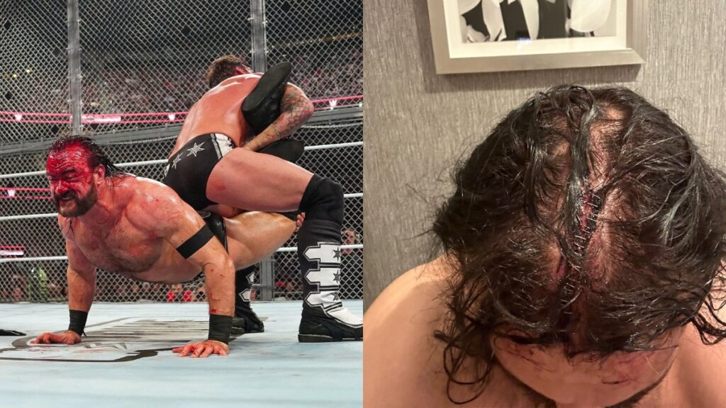 ¡Baño de sangre! Drew McIntyre recibe 16 grapas en la cabeza  tras masacre de CM Punk en el Bad Blood de la WWE