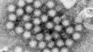 ¿Qué es el norovirus? Síntomas, cómo se contrae y tratamiento de esta enfermedad que ha aumentado sus casos en Estados Unidos