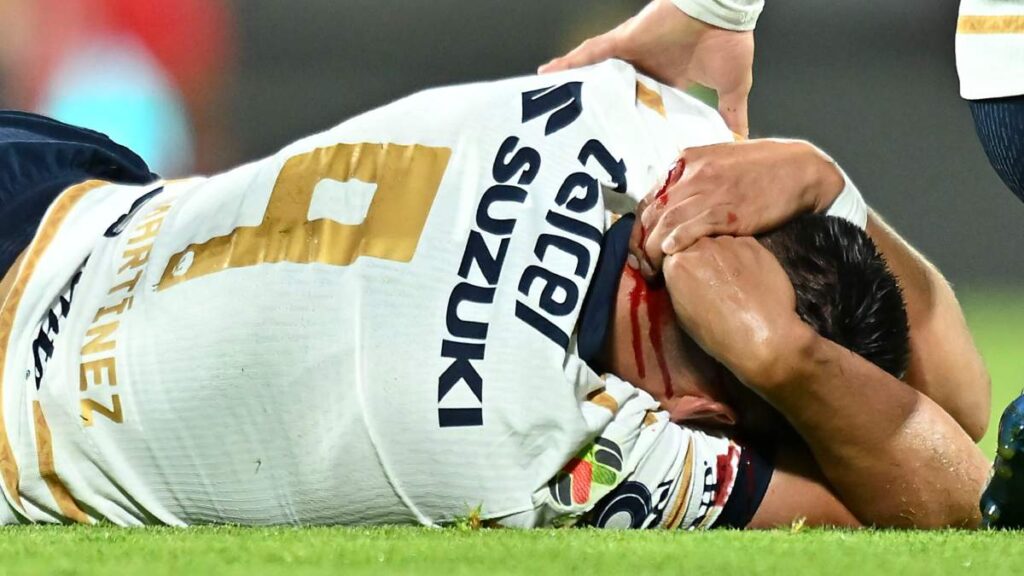 La impactante cicatriz del Memote Martínez tras golpe en la cabeza ante Toluca